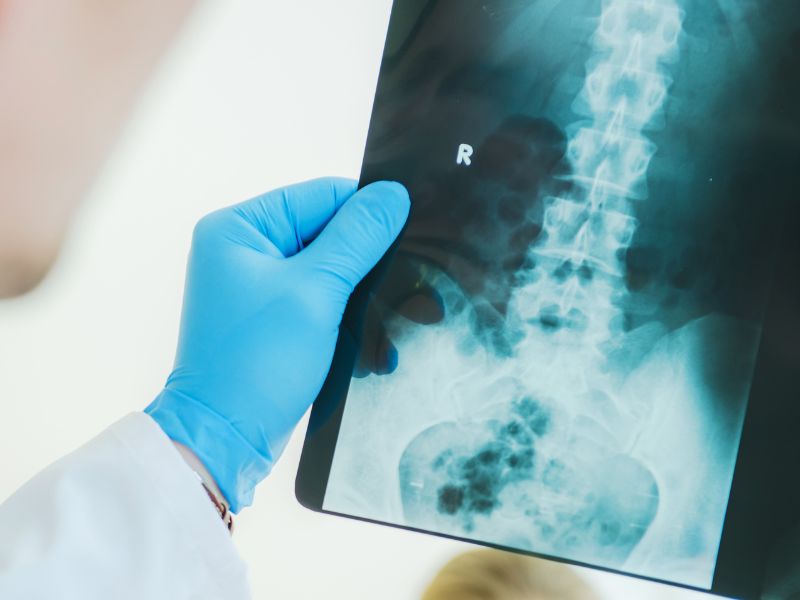 como é feito o exame de oncologia - acompanhamento