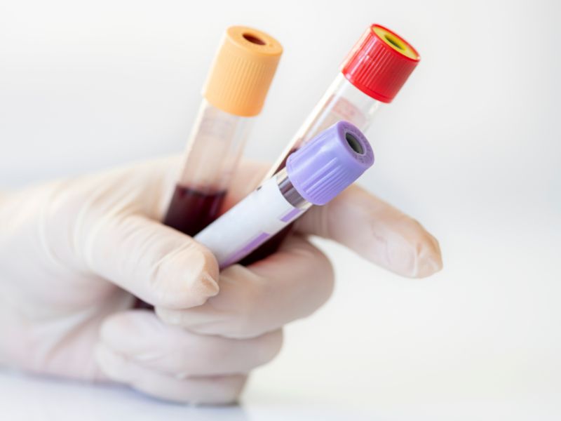 exames check-up homem 50 anos - hemograma